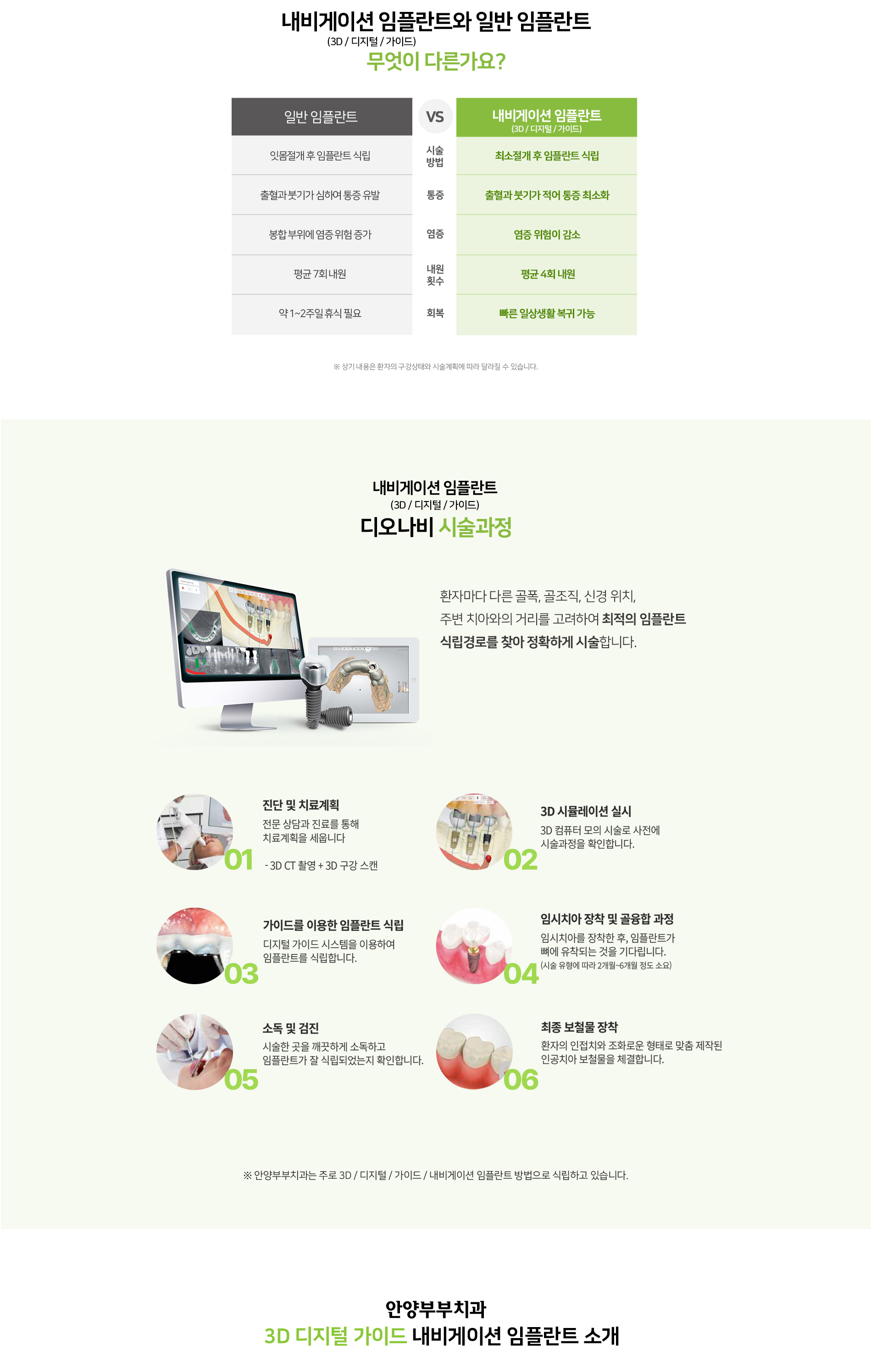 내비게이션 임플란트 소개 상단