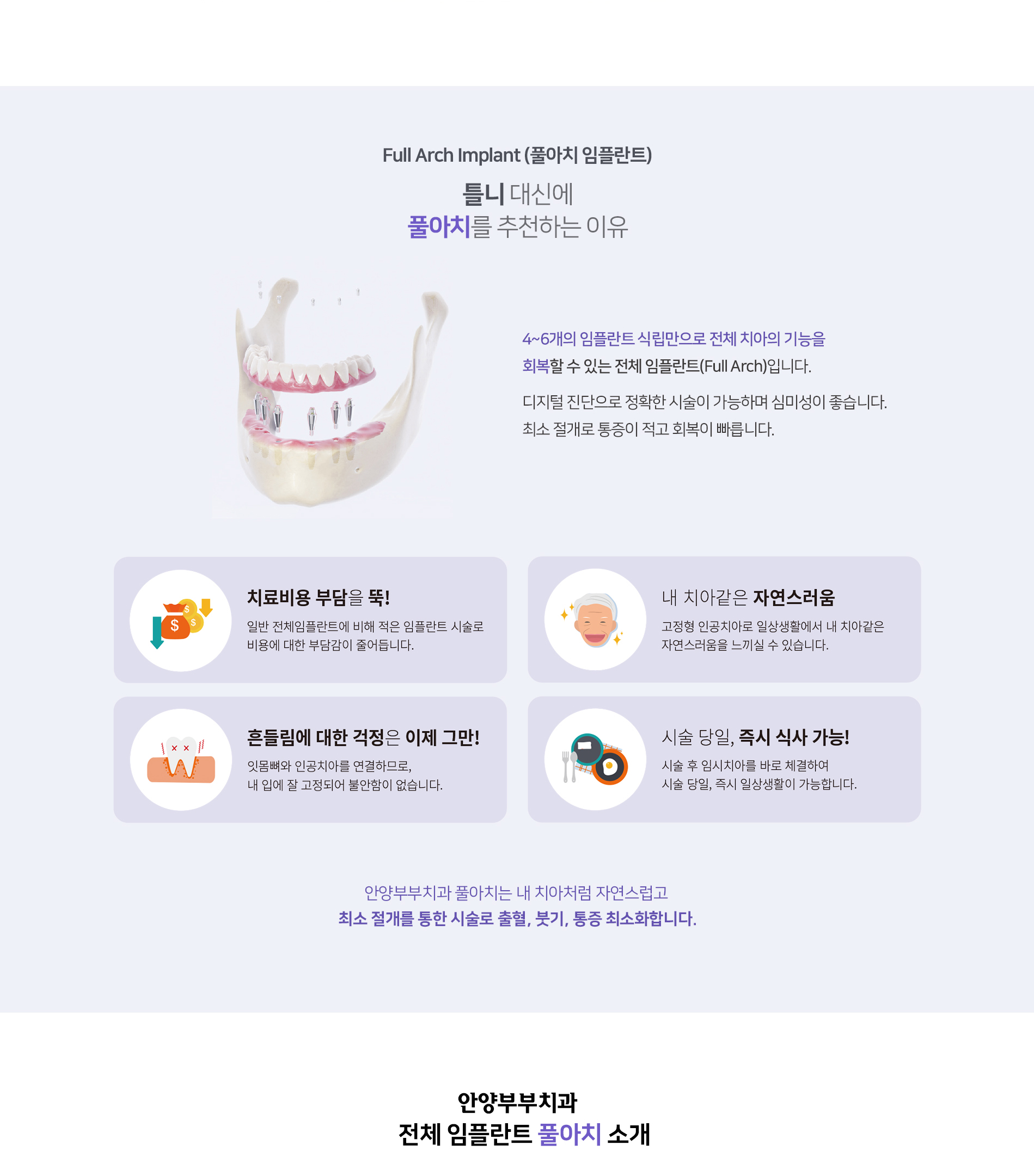 임플란트 중간 설명 이미지